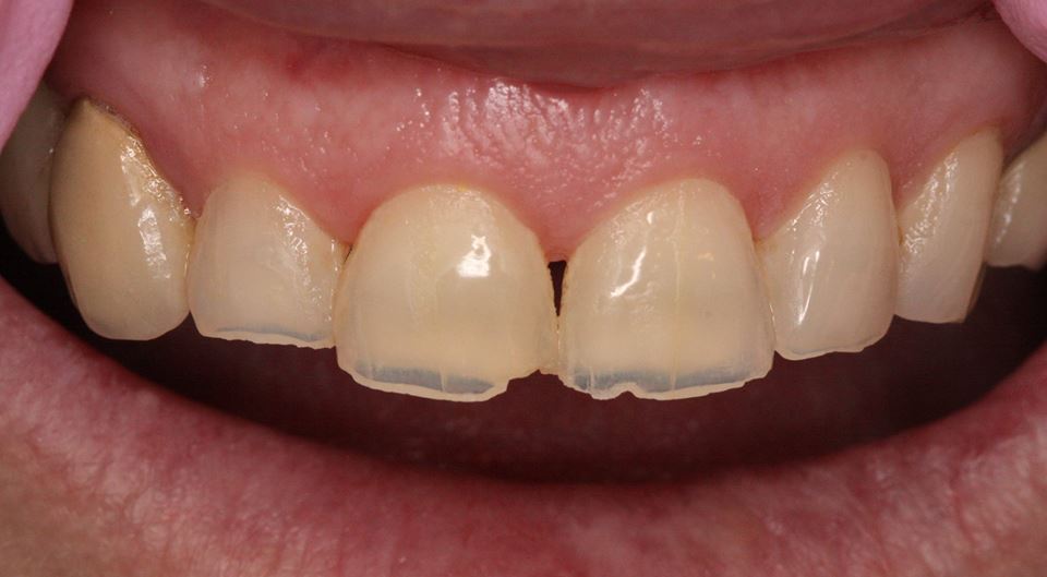 Dentist in Taunton, Lydeard Church House Dental 01823 430004