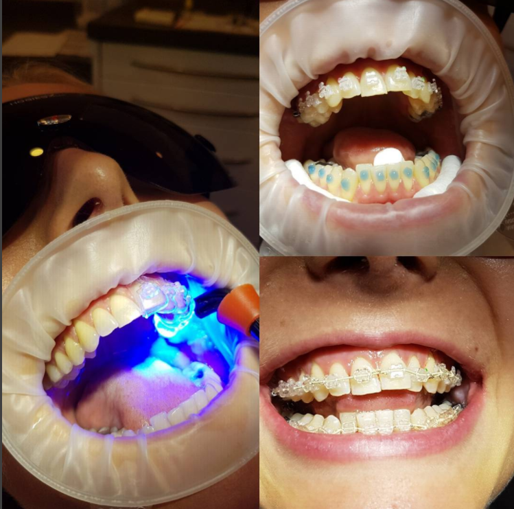 Dentist in Taunton, Lydeard Church House Dental 01823 430004