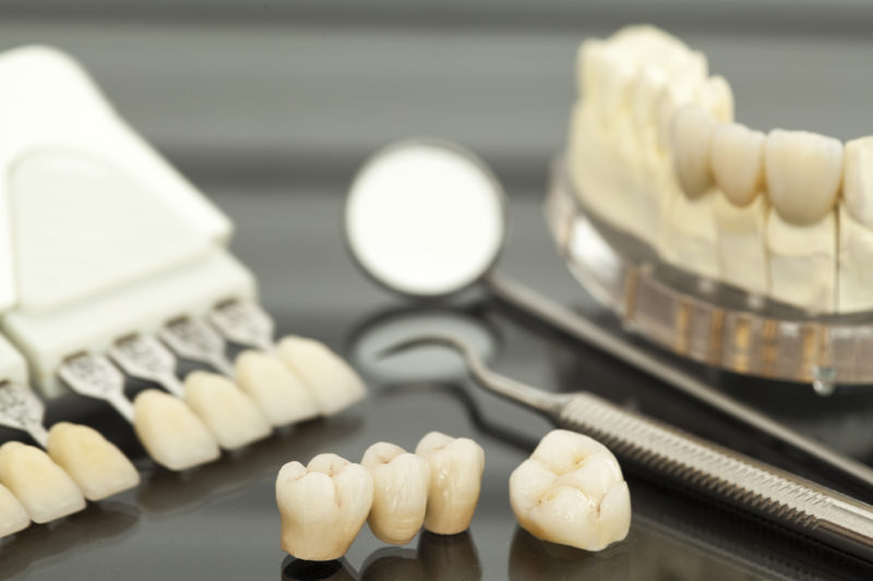 Photo of replacement teeth - churchhousedental.co.uk